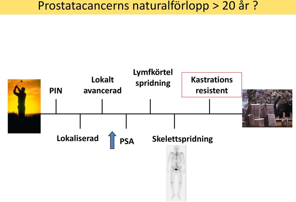 PIN Lokalt avancerad Lymfkörtel