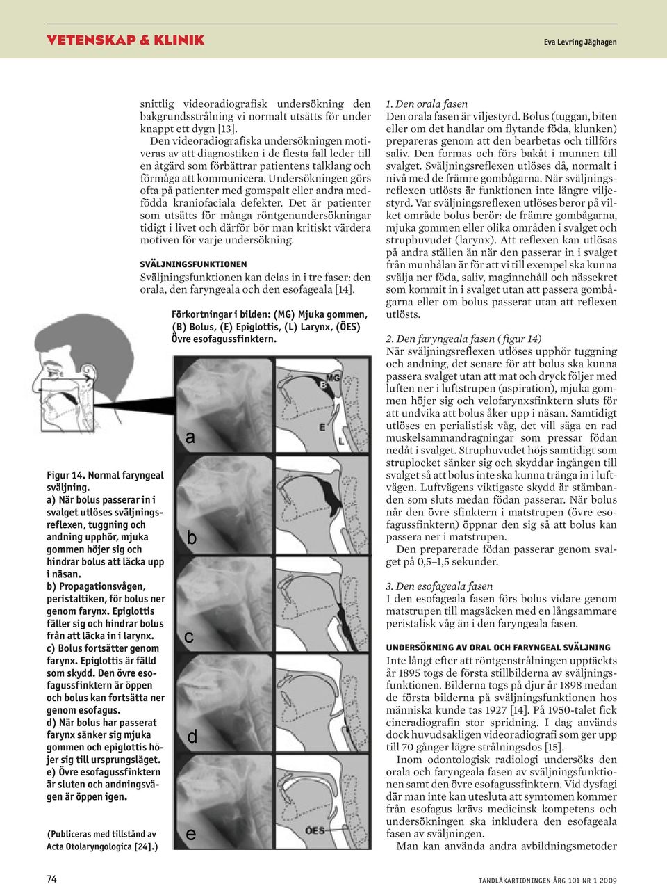 Den övre esofgussfinktern är öppen och olus kn fortsätt ner genom esofgus. d) När olus hr pssert frynx sänker sig mjuk gommen och epiglottis höjer sig till ursprungsläget.