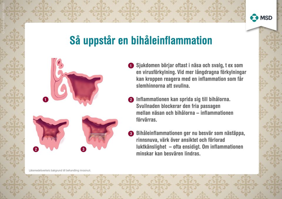 2 Inflammationen kan sprida sig till bihålorna. Svullnaden blockerar den fria passagen mellan näsan och bihålorna inflammationen förvärras.