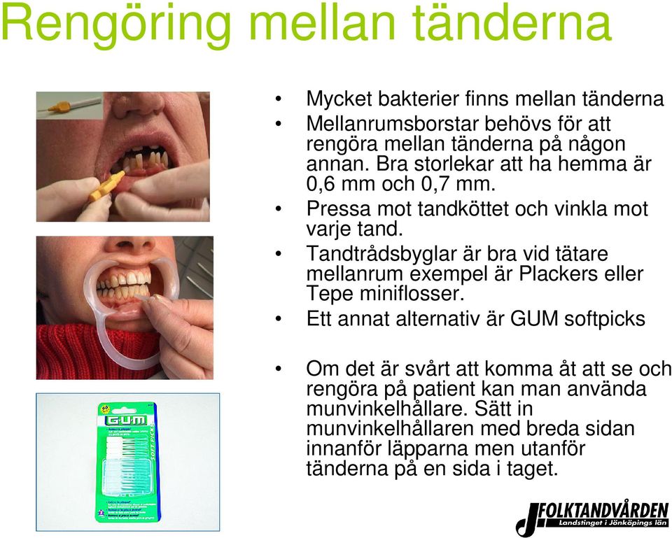 Tandtrådsbyglar är bra vid tätare mellanrum exempel är Plackers eller Tepe miniflosser.