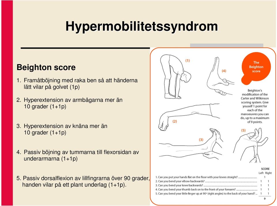 Hyperextension av armbågarna mer än 10 grader (1+1p) 3.