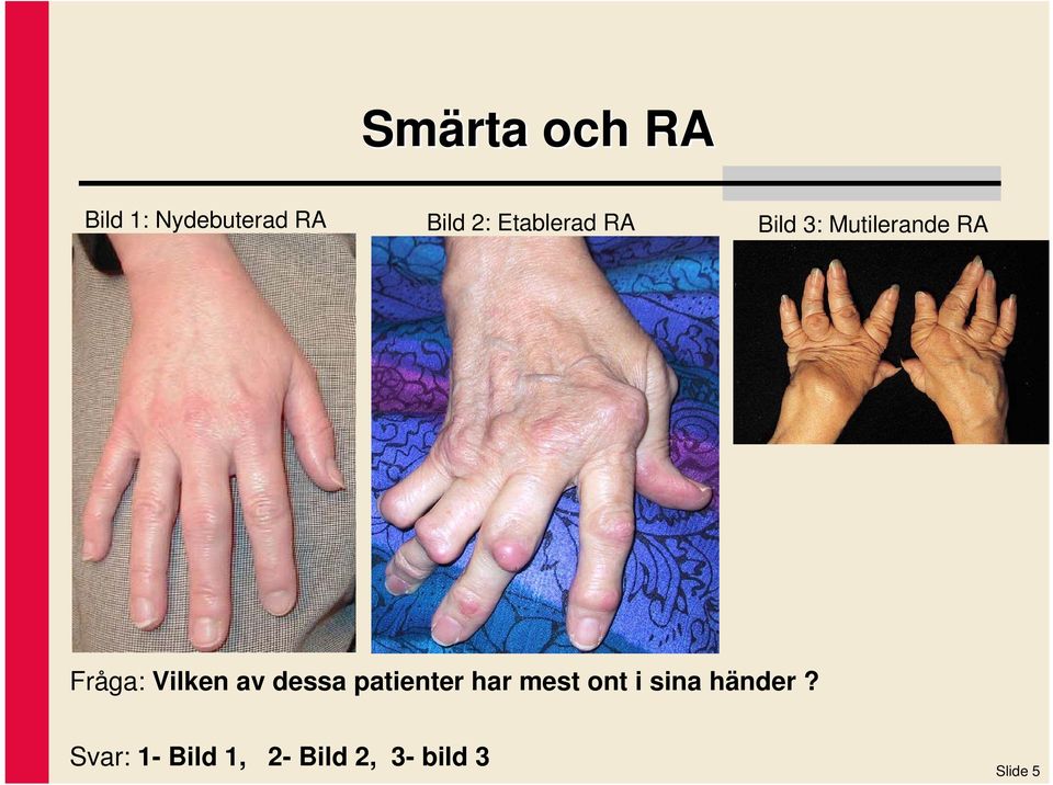 Vilken av dessa patienter har mest ont i sina