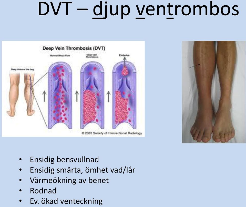 ömhet vad/lår Värmeökning av