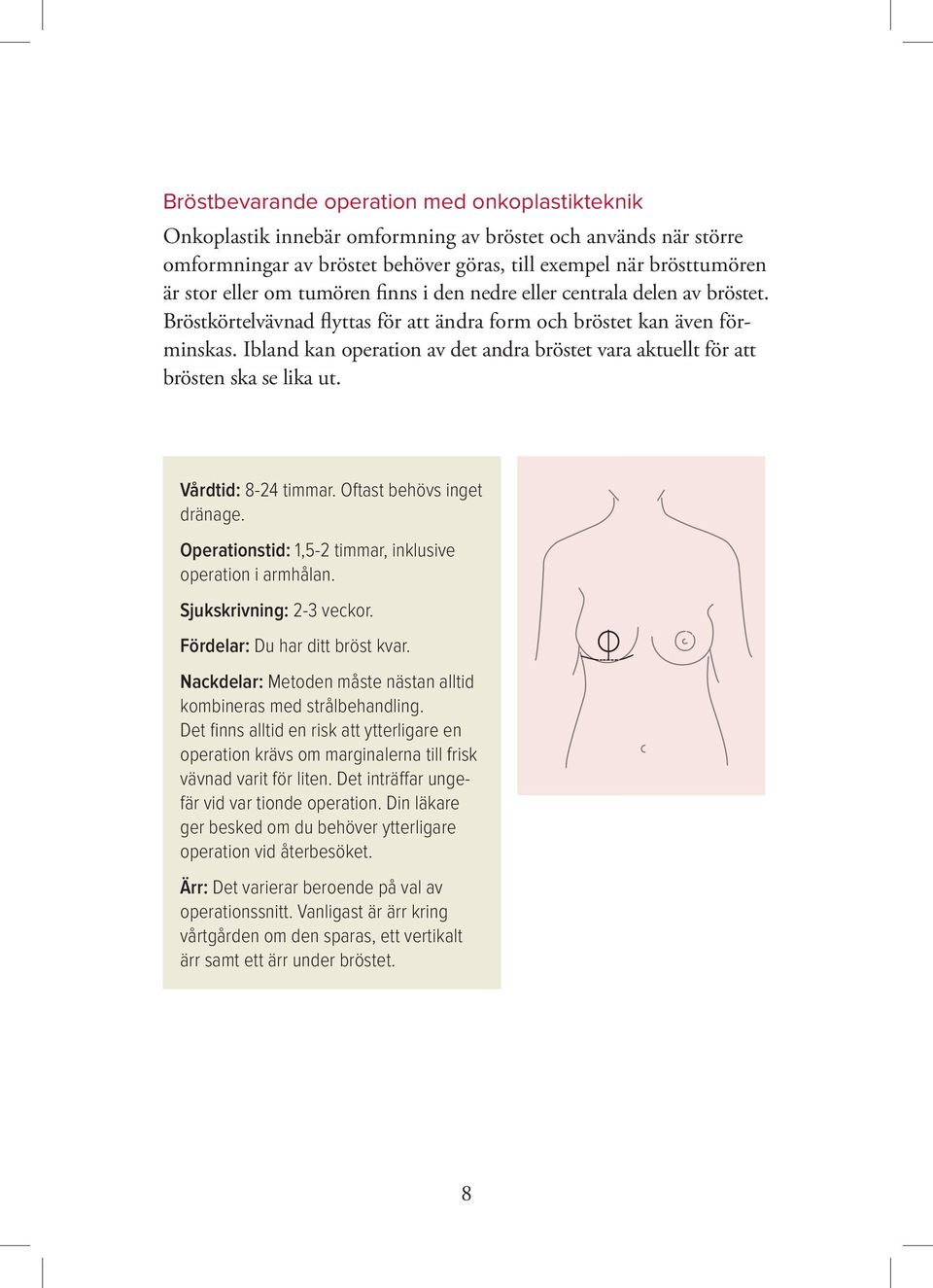 Ibland kan operation av det andra bröstet vara aktuellt för att brösten ska se lika ut. Vårdtid: 8-24 timmar. Oftast behövs inget dränage. Operationstid: 1,5-2 timmar, inklusive operation i armhålan.
