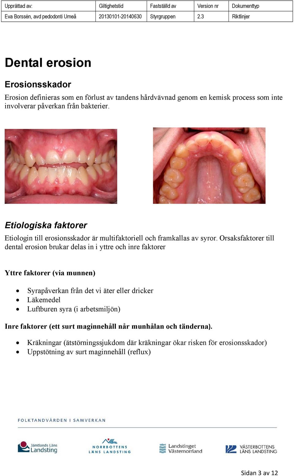 Orsaksfaktorer till dental erosion brukar delas in i yttre och inre faktorer Yttre faktorer (via munnen) Syrapåverkan från det vi äter eller dricker Läkemedel