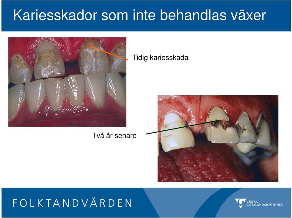 växer Tidig