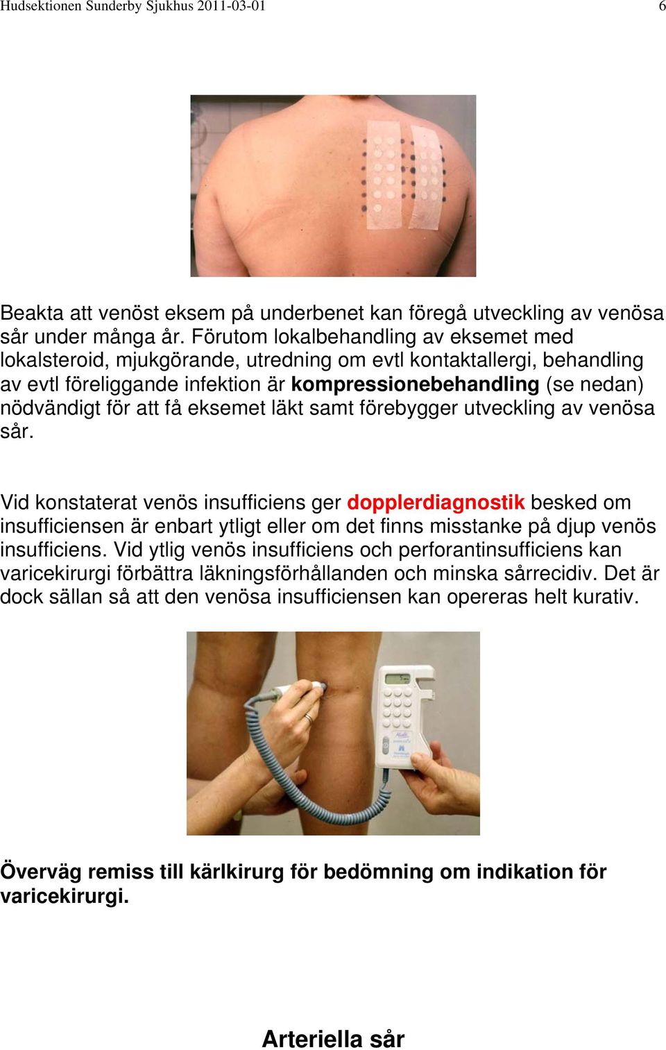 få eksemet läkt samt förebygger utveckling av venösa sår.