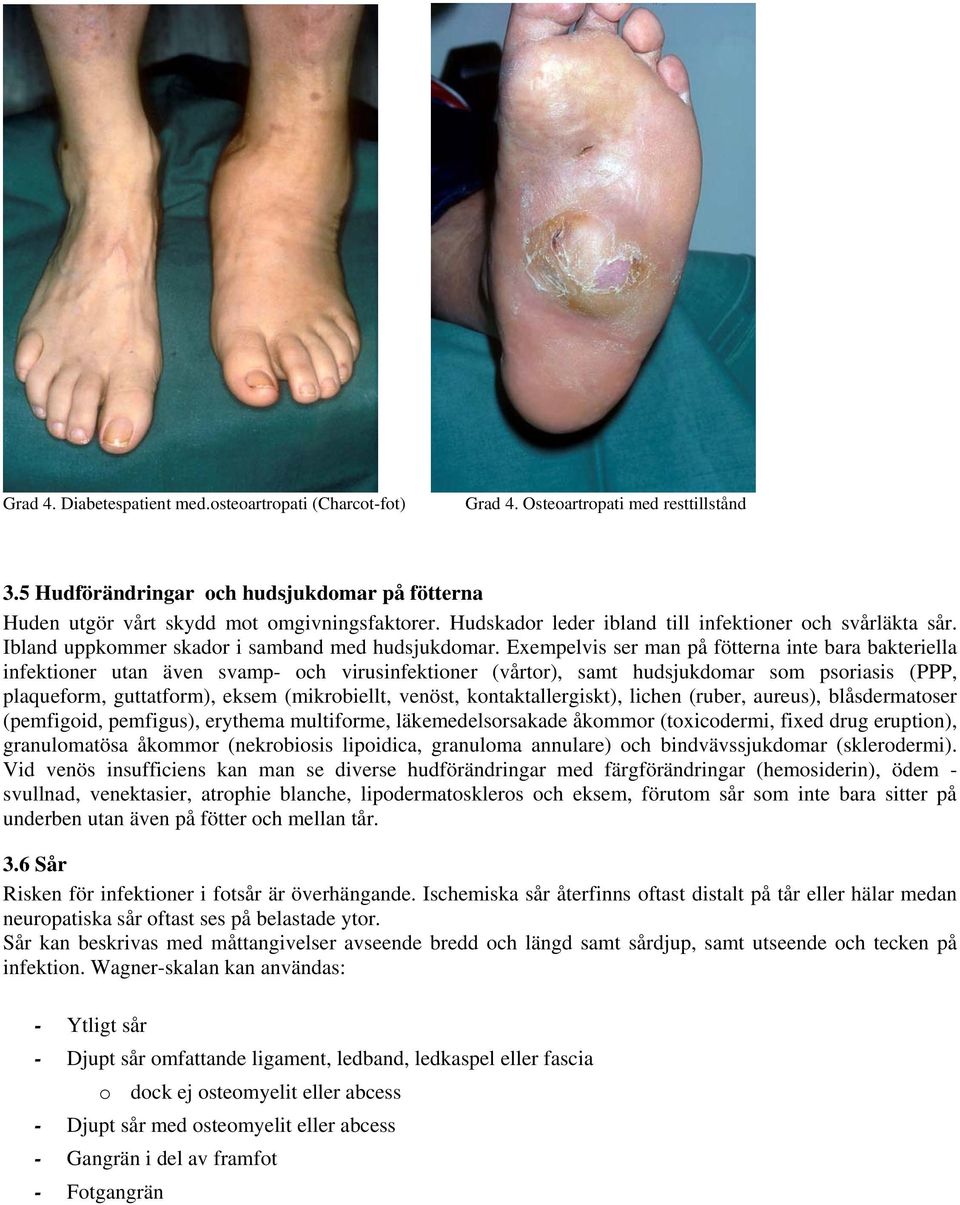 Exempelvis ser man på fötterna inte bara bakteriella infektioner utan även svamp- och virusinfektioner (vårtor), samt hudsjukdomar som psoriasis (PPP, plaqueform, guttatform), eksem (mikrobiellt,
