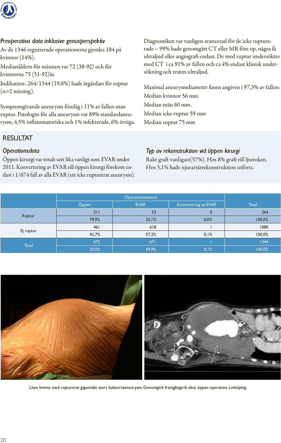 Patologin för alla aneurysm var 89% standardaneurysm, 4,5% inflammatoriska och 1% infekterade, 6% övriga.