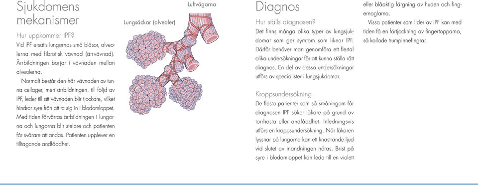 Normalt består den här vävnaden av tun- Det finns många olika typer av lungsjukdomar som ger symtom som liknar IPF.