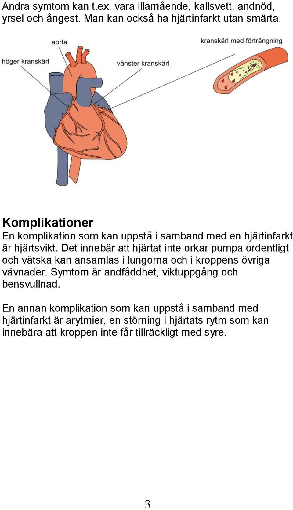 Det innebär att hjärtat inte orkar pumpa ordentligt och vätska kan ansamlas i lungorna och i kroppens övriga vävnader.