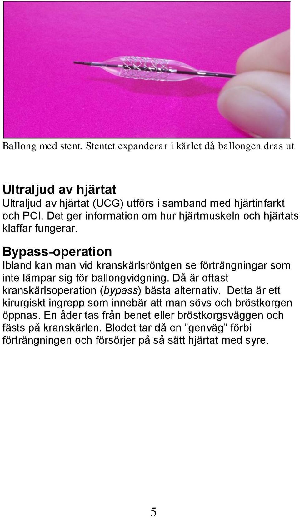 Bypass-operation Ibland kan man vid kranskärlsröntgen se förträngningar som inte lämpar sig för ballongvidgning.