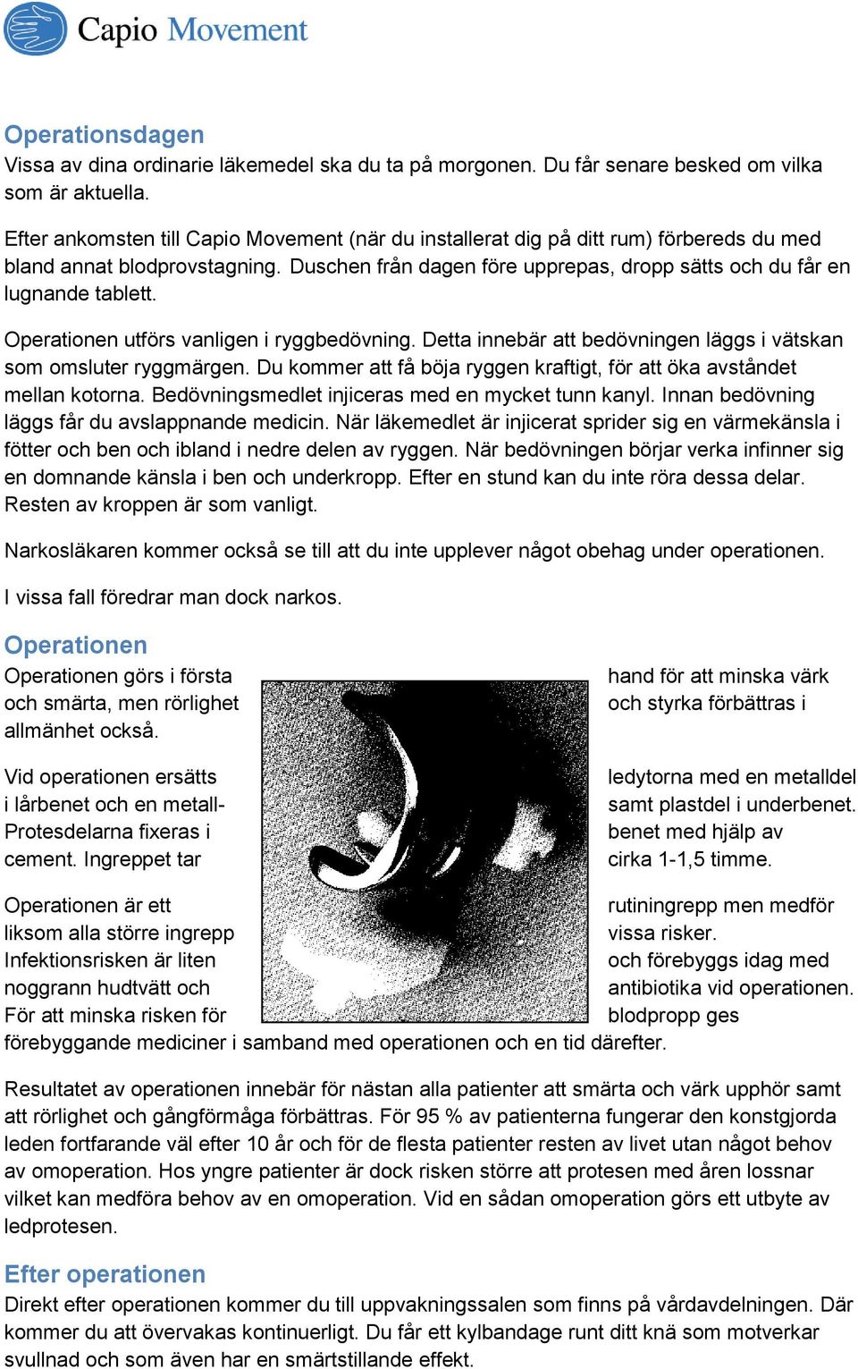 Operationen utförs vanligen i ryggbedövning. Detta innebär att bedövningen läggs i vätskan som omsluter ryggmärgen. Du kommer att få böja ryggen kraftigt, för att öka avståndet mellan kotorna.