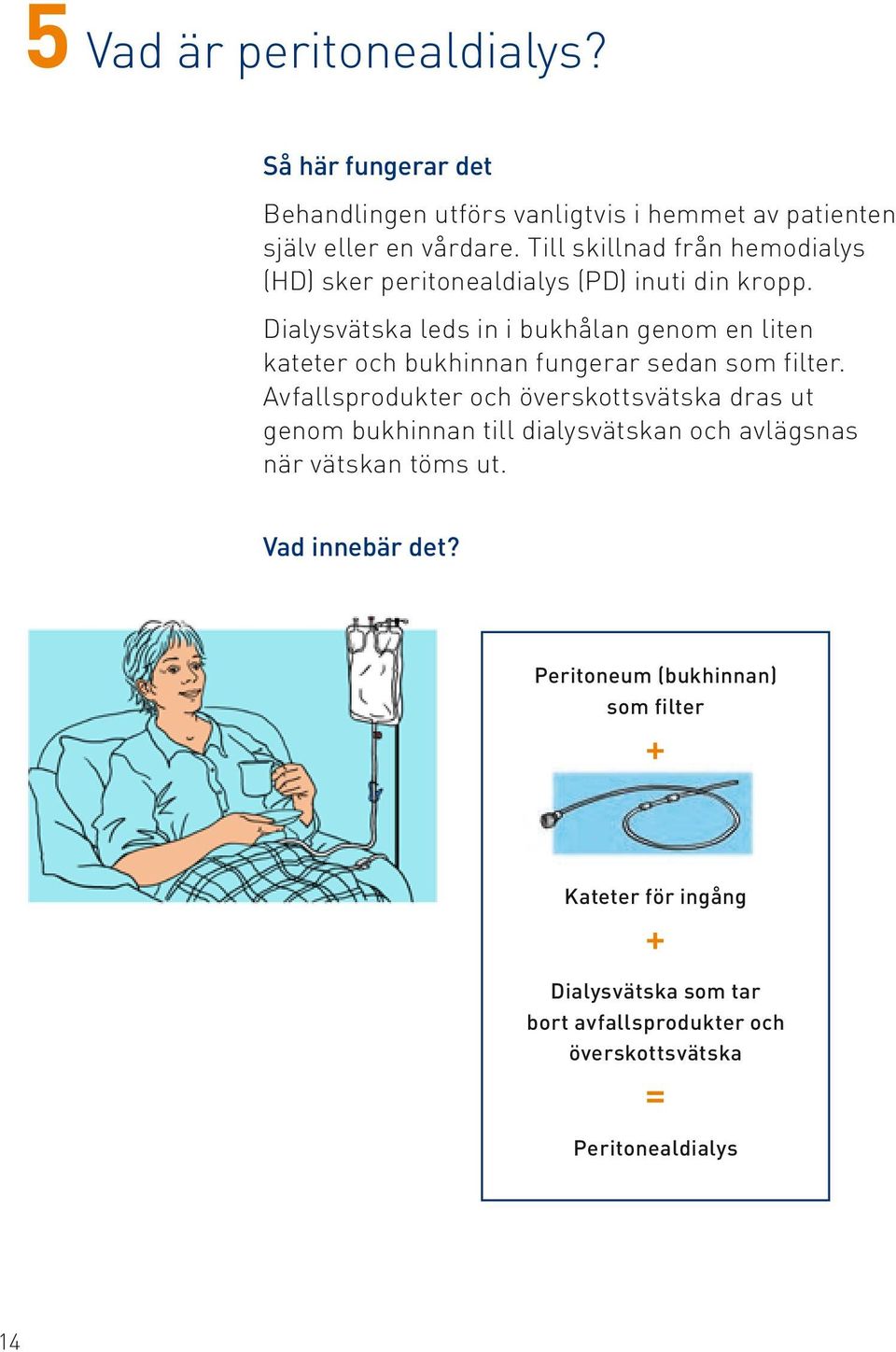 Dialysvätska leds in i bukhålan genom en liten kateter och bukhinnan fungerar sedan som filter.