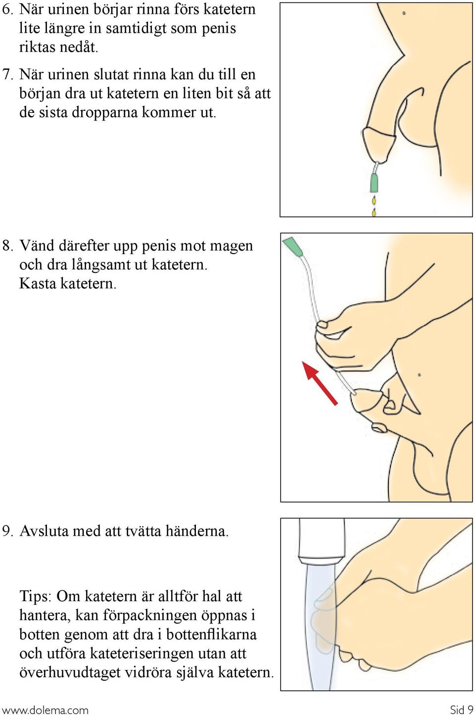 Vänd därefter upp penis mot magen och dra långsamt ut katetern. Kasta katetern. 9. Avsluta med att tvätta händerna.