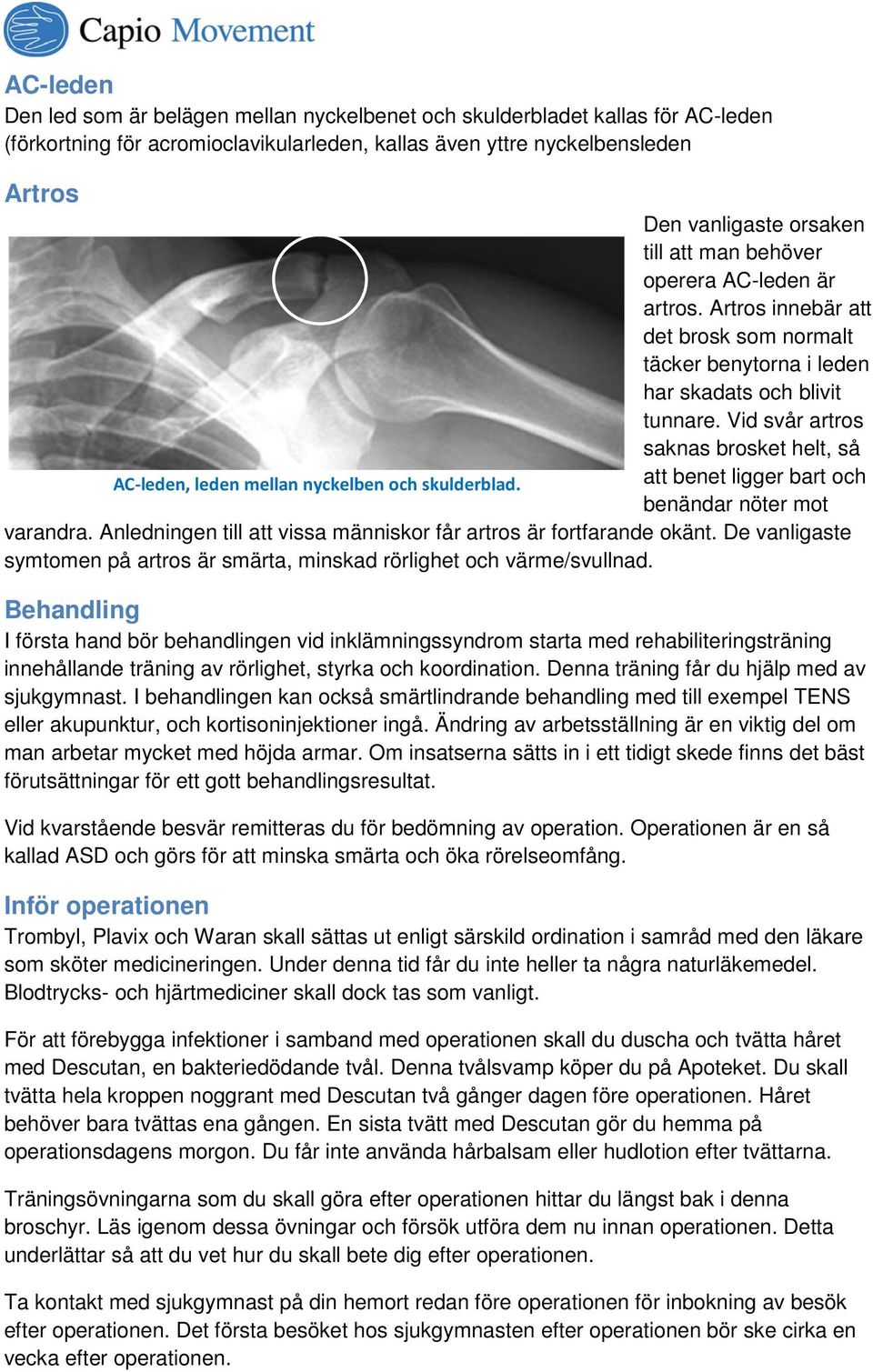 Vid svår artros saknas brosket helt, så AC-leden, leden mellan nyckelben och skulderblad. att benet ligger bart och benändar nöter mot varandra.