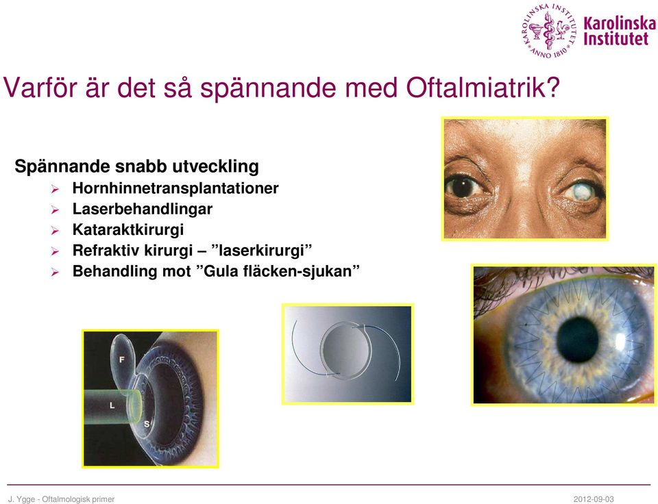 Hornhinnetransplantationer Laserbehandlingar