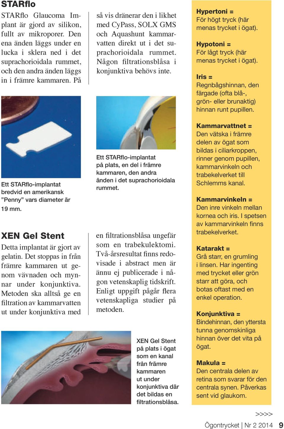 På Ett STARflo-implantat bredvid en amerikansk Penny vars diameter är 19 mm. XEN Gel Stent Detta implantat är gjort av gelatin.