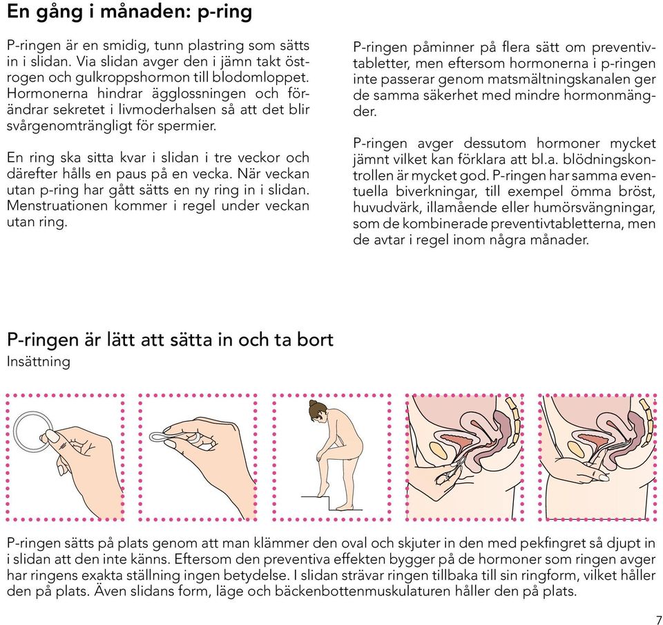 En ring ska sitta kvar i slidan i tre veckor och därefter hålls en paus på en vecka. När veckan utan p-ring har gått sätts en ny ring in i slidan. Menstruationen kommer i regel under veckan utan ring.