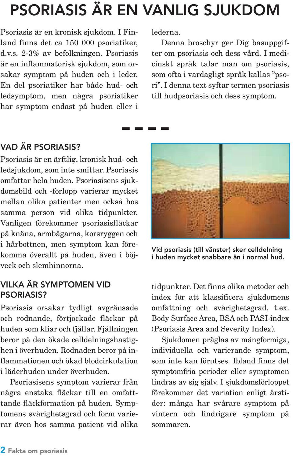 Denna broschyr ger Dig basuppgifter om psoriasis och dess vård. I medicinskt språk talar man om psoriasis, som ofta i vardagligt språk kallas psori.