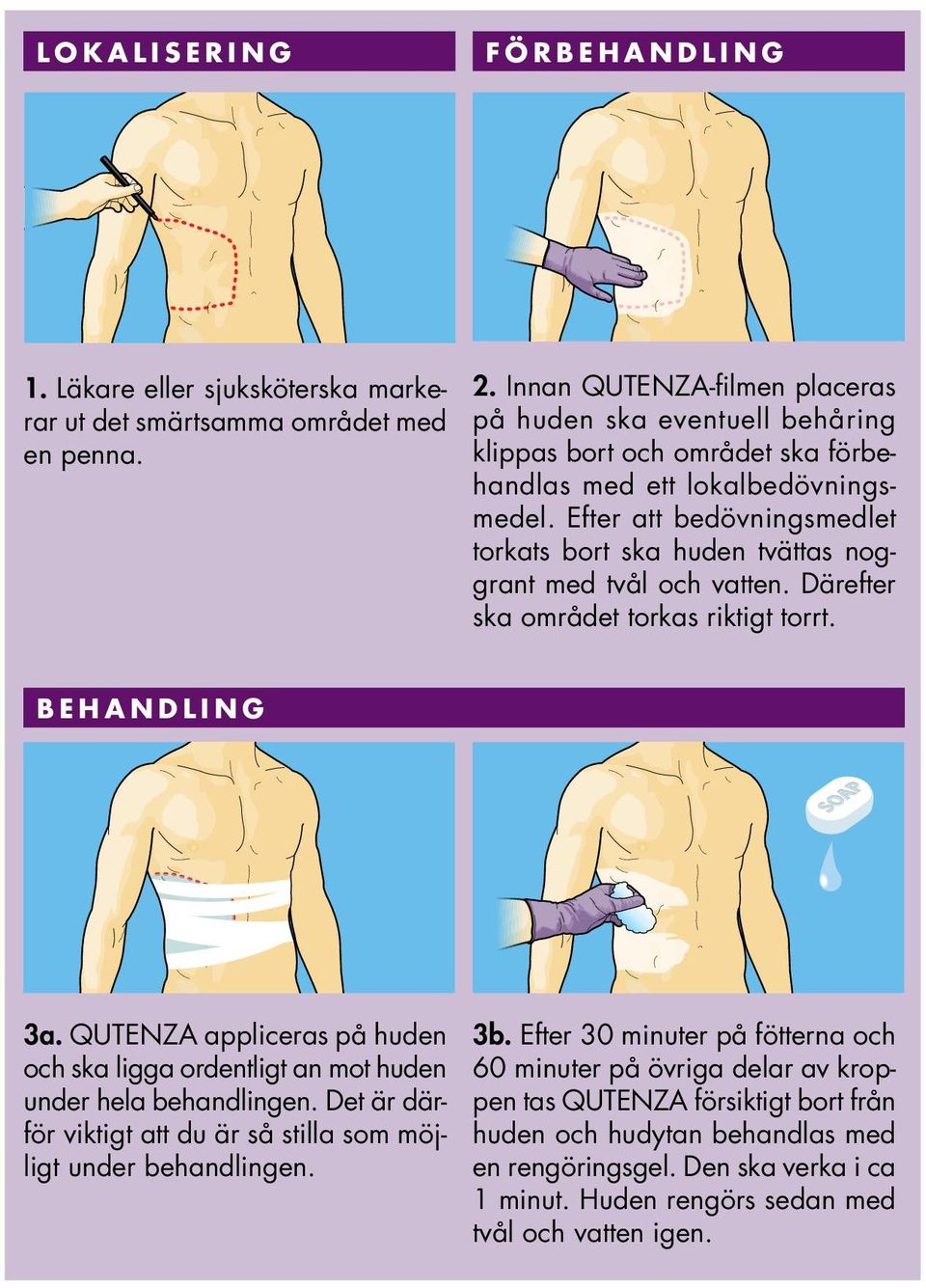 Efter att bedövningsmedlet torkats bort ska huden tvättas noggrant med tvål och vatten. Därefter ska området torkas riktigt torrt. B E H A N D L I N G 3a.