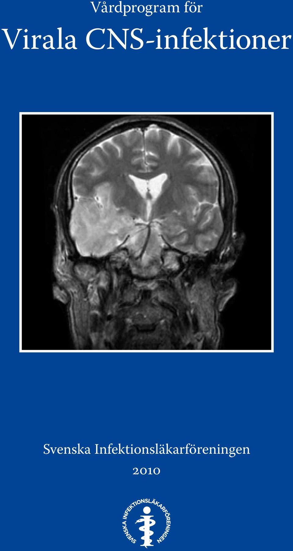 CNS-infektioner
