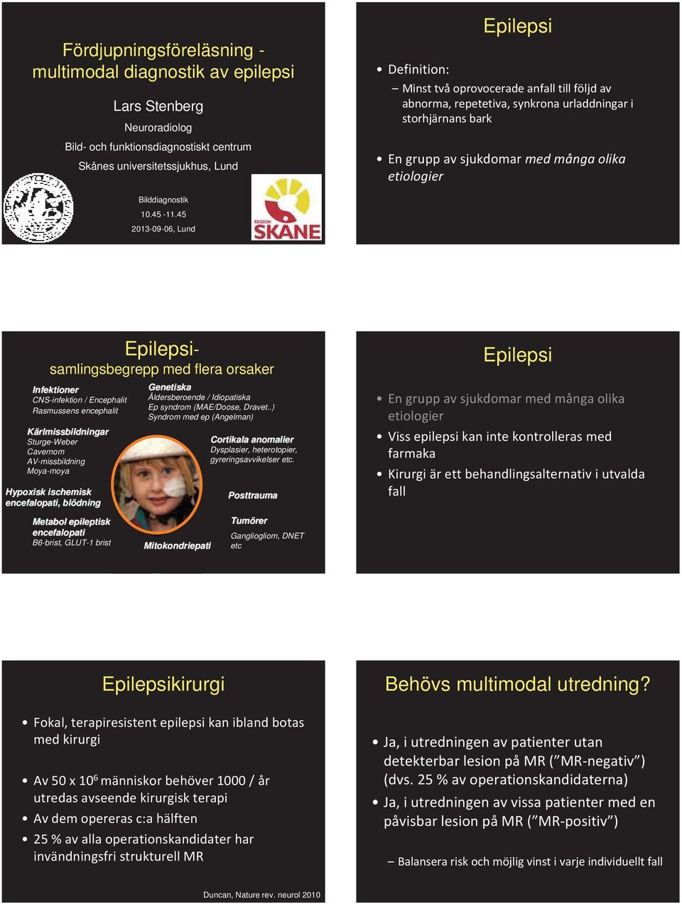 45 2013-09-06, Lund Epilepsisamlingsbegrepp med flera orsaker Infektioner CNS-infektion / Encephalit Rasmussens encephalit Kärlmissbildningar Sturge-Weber Cavernom AV-missbildning Moya-moya Hypoxisk