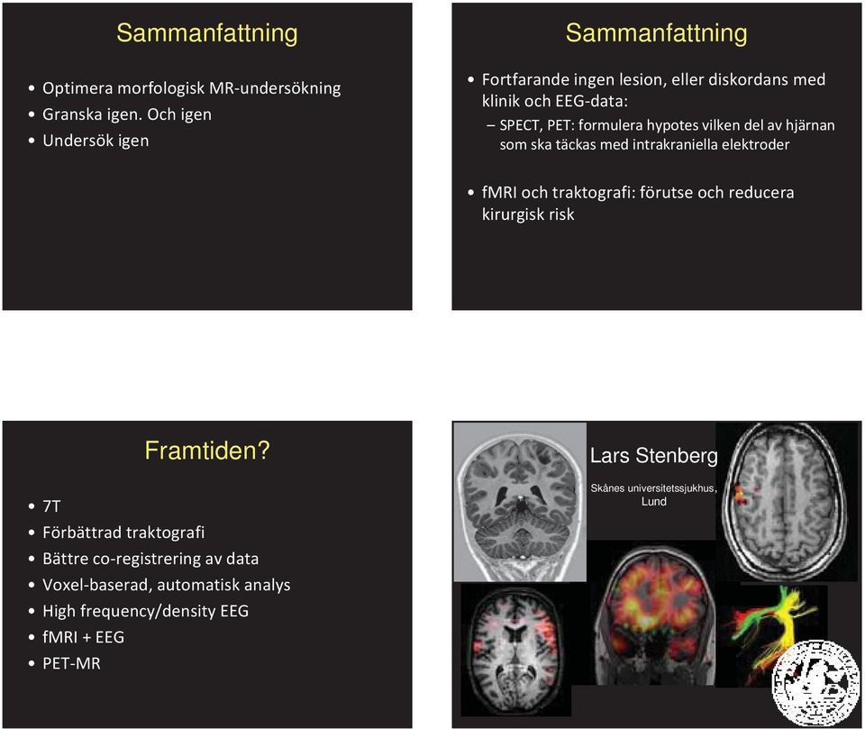 hypotes vilken del av hjärnan som ska täckas med intrakraniella elektroder fmri och traktografi: förutse och reducera kirurgisk