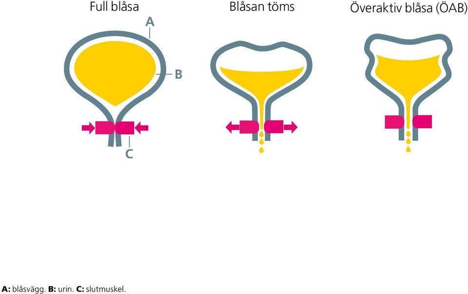 (ÖAB) B C A: blåsvägg.