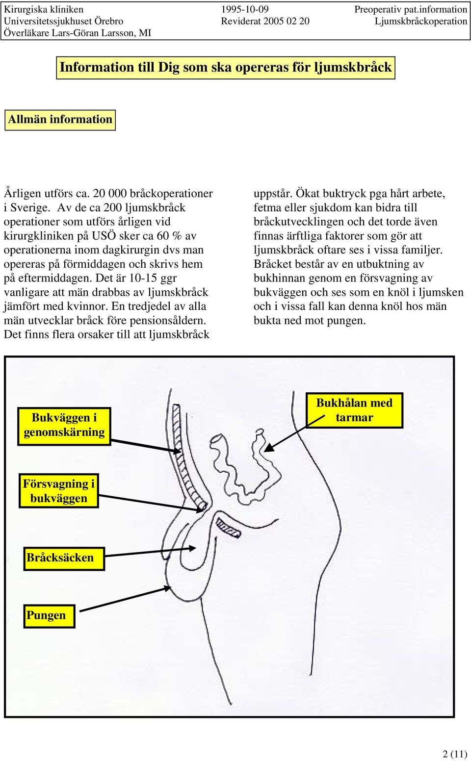 Det är 10-15 ggr vanligare att män drabbas av ljumskbråck jämfört med kvinnor. En tredjedel av alla män utvecklar bråck före pensionsåldern. Det finns flera orsaker till att ljumskbråck uppstår.