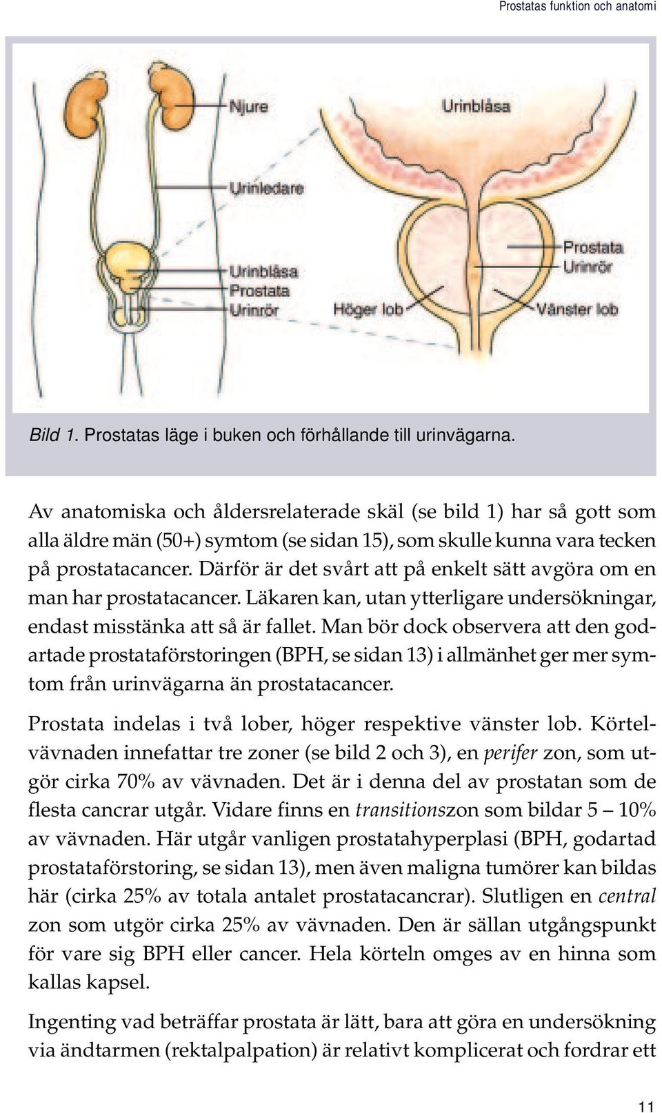 Därför är det svårt att på enkelt sätt avgöra om en man har prostatacancer. Läkaren kan, utan ytterligare undersökningar, endast misstänka att så är fallet.
