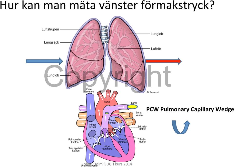 förmakstryck?
