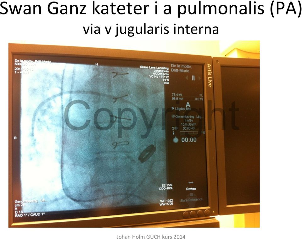 pulmonalis (PA)