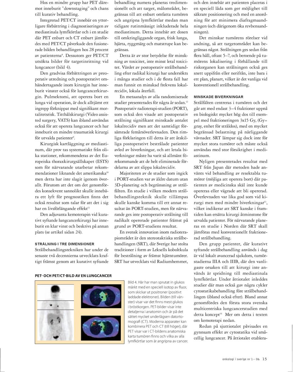 behandlingen hos 28 procent av patienterna 8. Dessutom ger PET/CT utsökta bilder för targetinritning vid lungcancer (bild 4).