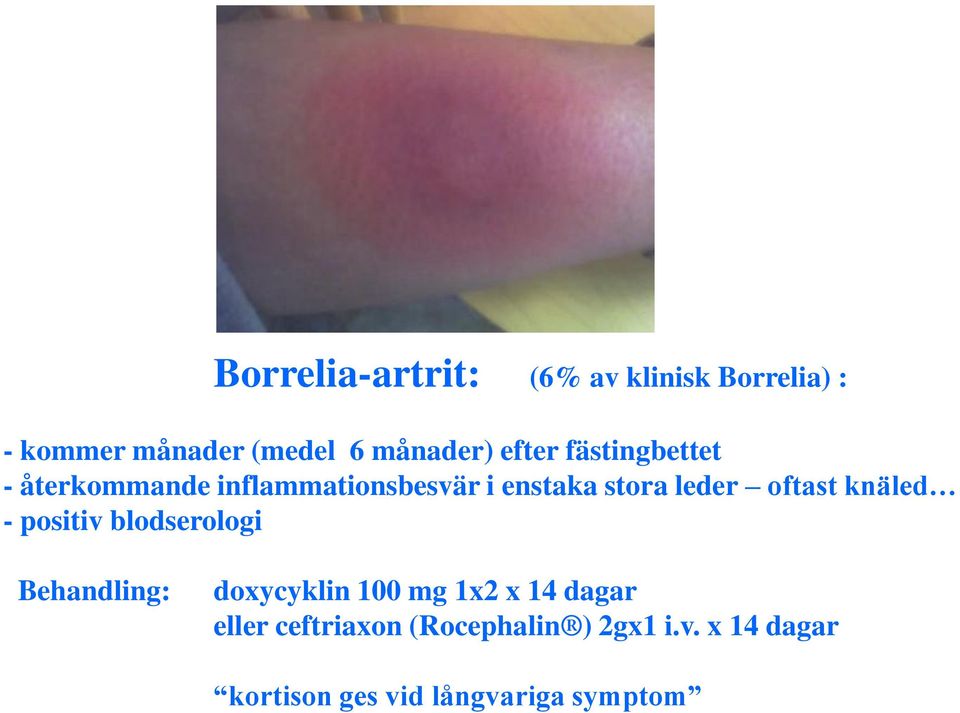 oftast knäled - positiv blodserologi Behandling: doxycyklin 100 mg 1x2 x 14 dagar