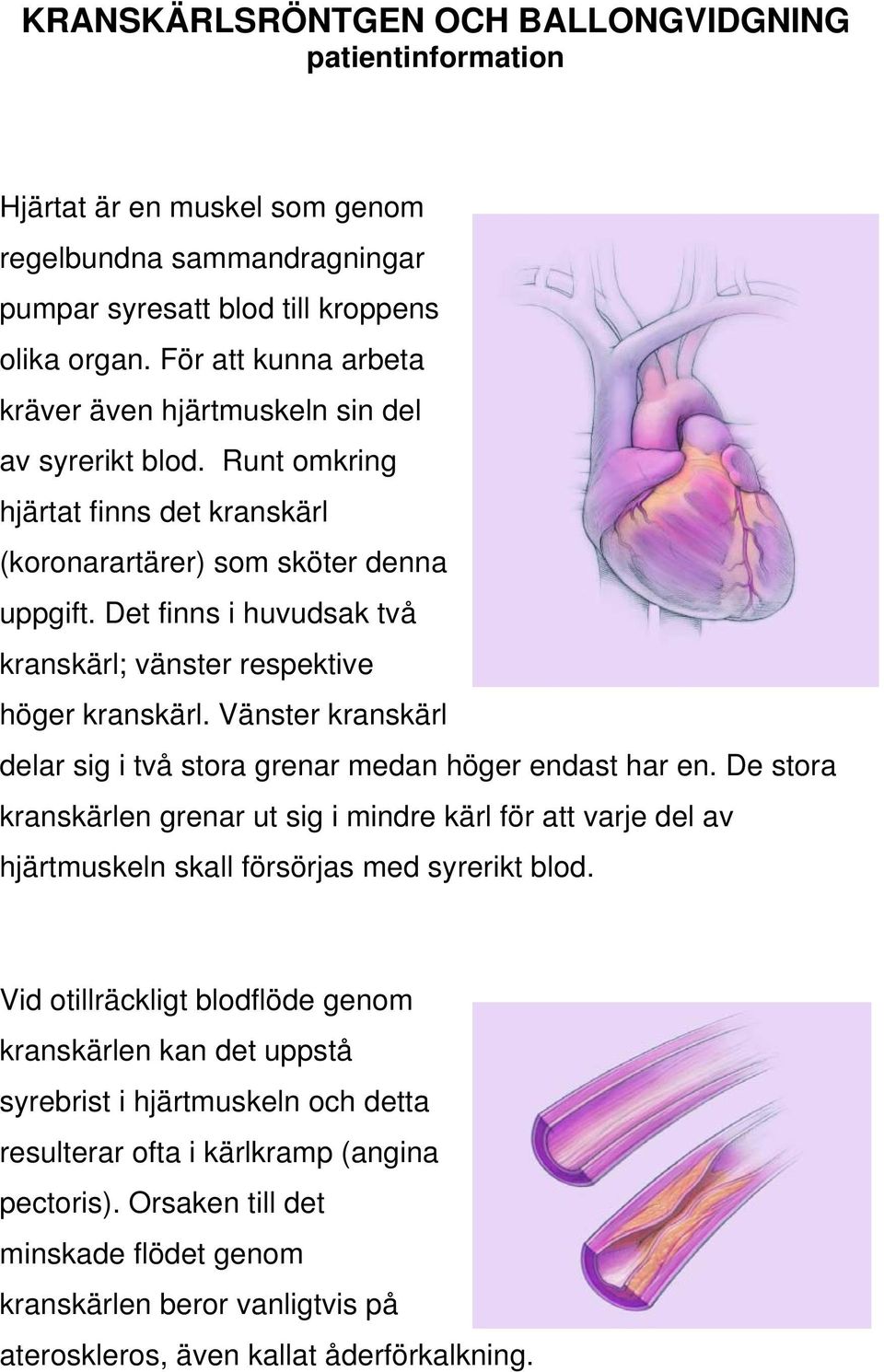 Det finns i huvudsak två kranskärl; vänster respektive höger kranskärl. Vänster kranskärl delar sig i två stora grenar medan höger endast har en.