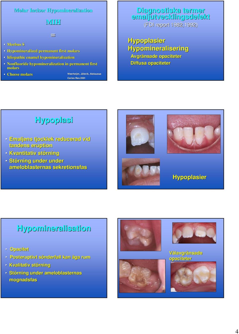 Avgränsade opaciteter Diffusa opaciteter Hypoplasi Emaljens tjocklek reducerad vid tandens eruption Kvantitativ störning Störning under under ameloblasternas