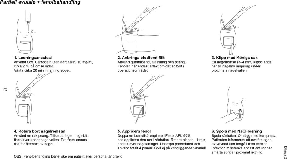 Fenolen har endast effekt om det är torrt i ner till nagelns ursprung under Vänta cirka 20 min innan ingreppet. operationsområdet. proximala nagelvallen. 4. Rotera bort nagelremsan 5.