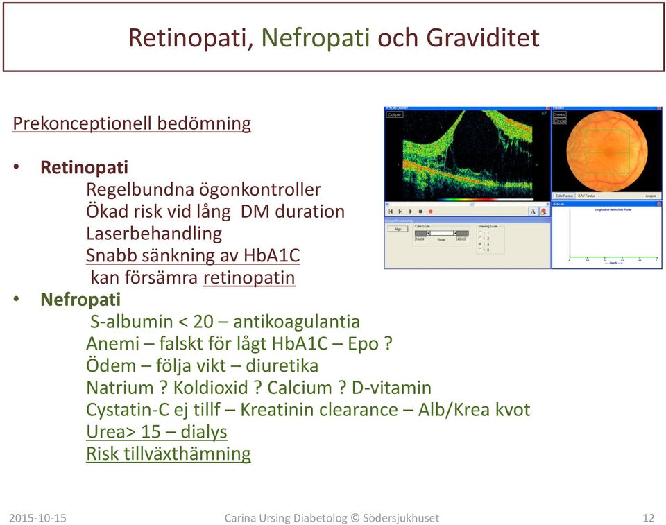 S-albumin < 20 antikoagulantia Anemi falskt för lågt HbA1C Epo? Ödem följa vikt diuretika Natrium?