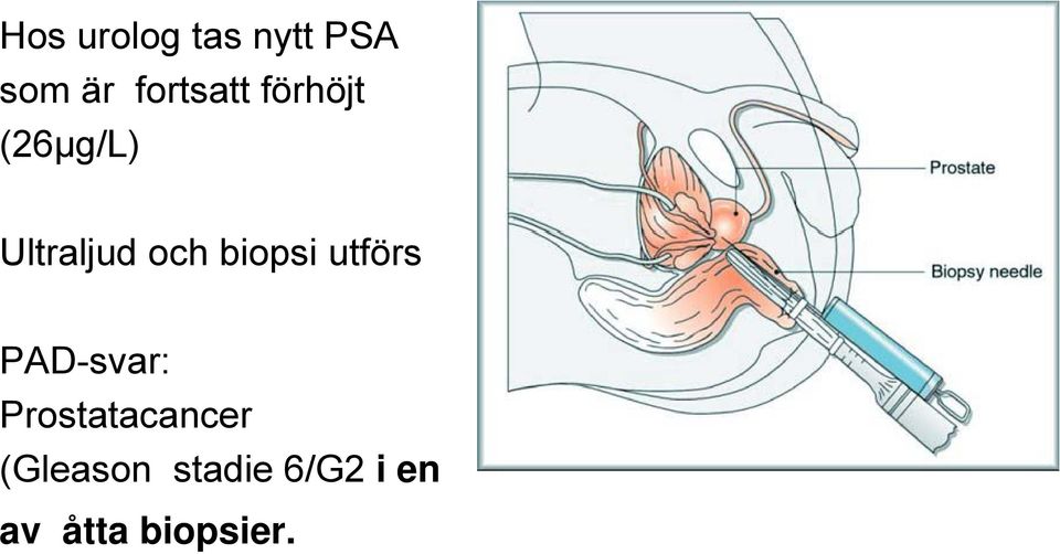 och biopsi utförs PAD-svar: