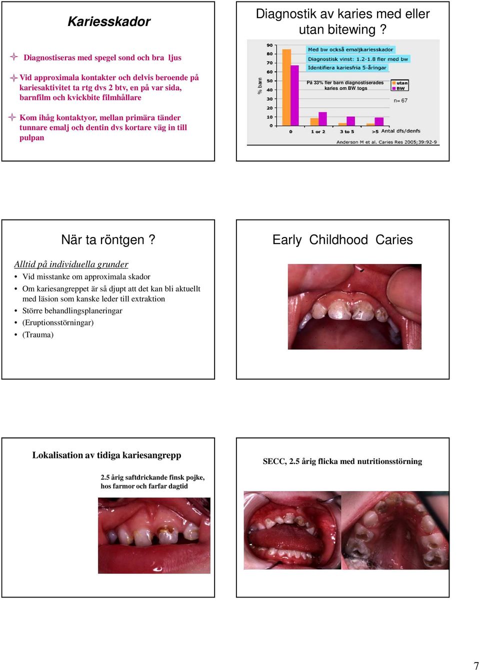 mellan primära tänder tunnare emalj och dentin dvs kortare väg in till pulpan På 33% fler barn diagnostiserades karies om BW togs n= 67 När ta röntgen?