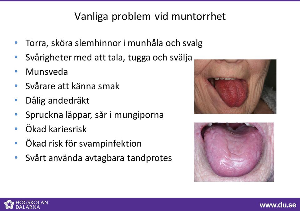 känna smak Dålig andedräkt Spruckna läppar, sår i mungiporna Ökad