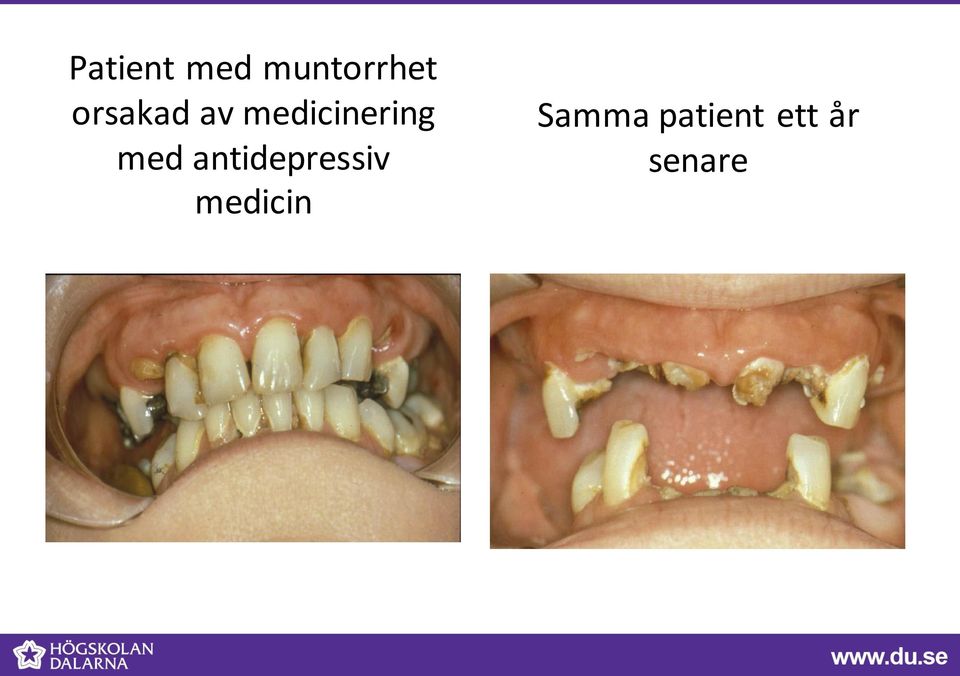 med antidepressiv