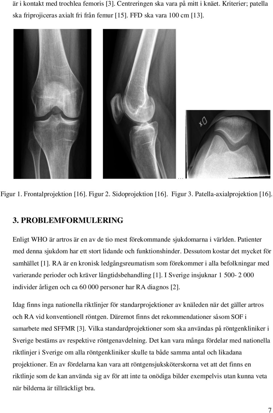 Patienter med denna sjukdom har ett stort lidande och funktionshinder. Dessutom kostar det mycket för samhället [1].