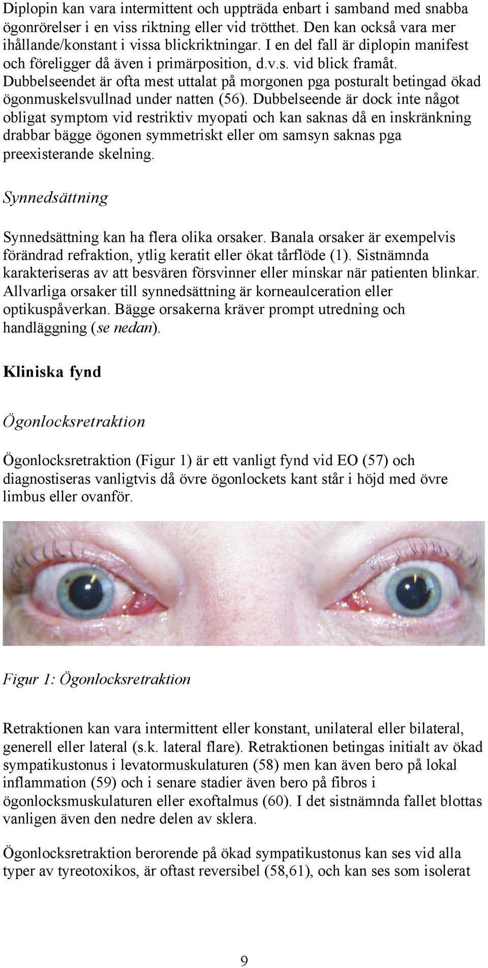 Dubbelseendet är ofta mest uttalat på morgonen pga posturalt betingad ökad ögonmuskelsvullnad under natten (56).