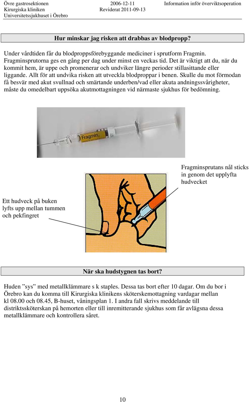 Skulle du mot förmodan få besvär med akut svullnad och smärtande underben/vad eller akuta andningssvårigheter, måste du omedelbart uppsöka akutmottagningen vid närmaste sjukhus för bedömning.