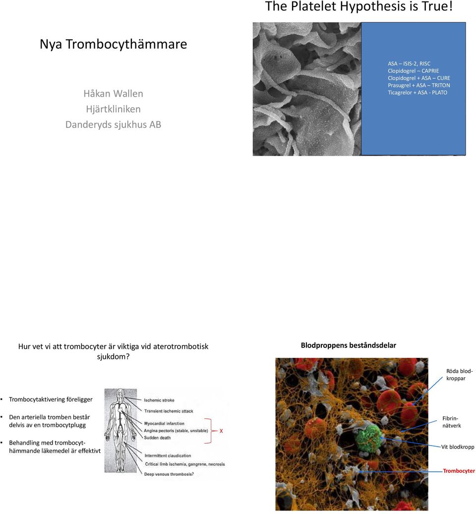 CURE Prasugrel + ASA TRITON Ticagrelor + ASA - PLATO Hur vet vi att trombocyter är viktiga vid aterotrombotisk sjukdom?