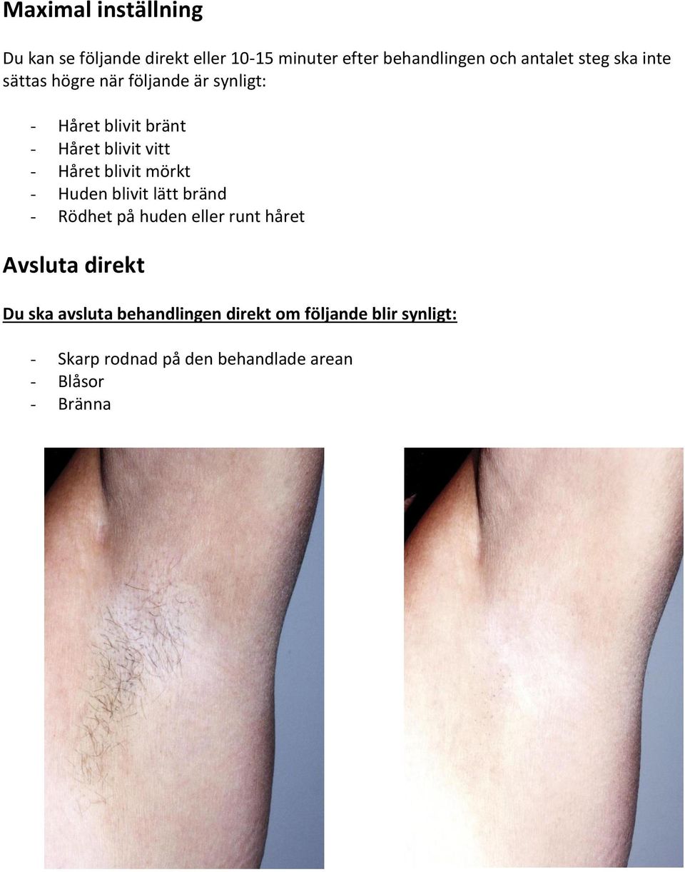 blivit mörkt - Huden blivit lätt bränd - Rödhet på huden eller runt håret Avsluta direkt Du ska