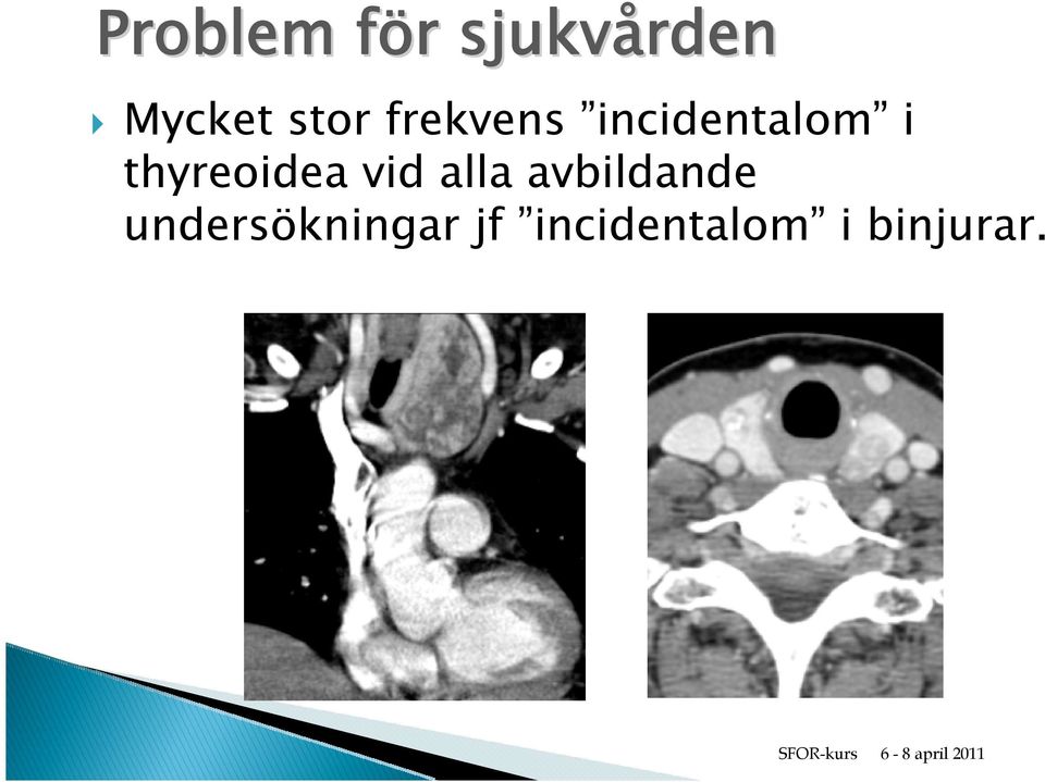 thyreoidea vid alla avbildande