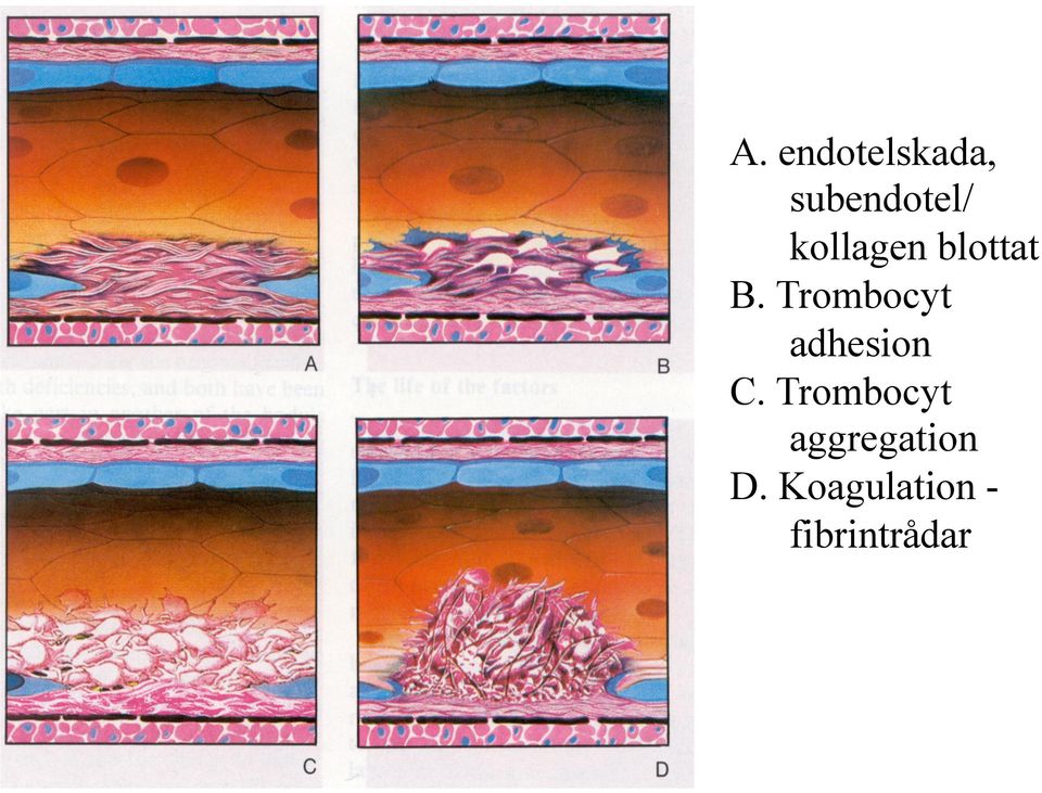 Trombocyt adhesion C.